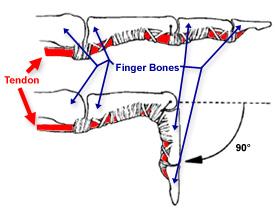 손가락의장굴곡근 (long flexor) 검사 (2)