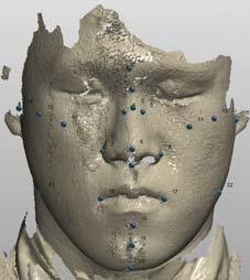 Oxygen Mask Design Method based on 3D Face Scanning MathWorks, Inc., USA) 으로구현한 program을사용하여자동측정된다. 그림 2.b와같이 3차원 scan을통해파악된안면부의 3차원형상 data와치수들은마스크착용특성및마스크설계방향분석에활용된다.