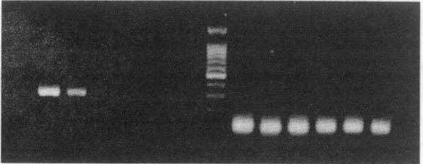 1 2 3 4 5 6 M 7 8 9 10 1112 찰할수가있었다. As203 가 APL 세포주에서아포토 시스억제자 (apoptosis inhibitor) 인 bcl-2 를 mrna 와 단백질단계에서둘다효과적으로하향조절할수 305 bp-' 105 bp-' Fig. 3. RT-PCR results of bcr-abl rearrangment.