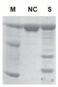 ) M: 1 kb DNA Ladder (D-1040, Bioneer), NC: Negative control (No DNase I treated) S: DNase I treated sample (B) Proteinase K M NC S BSA protein was degraded by