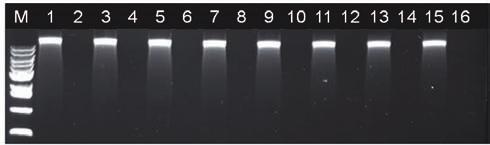 Experimental Data Figure 1: 전혈에서추출된 genomic DNA 의전기영동분석결과 M; Size marker (1 kb DNA Ladder, D-1040, Bioneer) S; Extraction with whole blood sample B; Extraction with D.W.