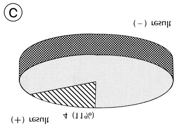 Fig. 1. Laryngoscopic findings according to Yonekawa 1998. Fig. 2. possible etiologic factors.