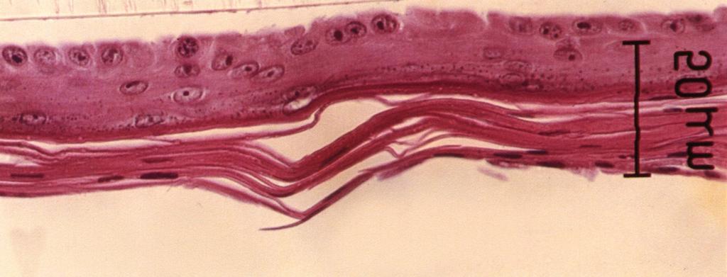 이는 공기중으로의 노출이 진주종 상피 세포의 각질화에 필수적이라는 사실을 말해주고 있다. A B C D B Fig. 1. The morphology of the epithelium formed by human cholesteatoma epithelial (HCE) cells.