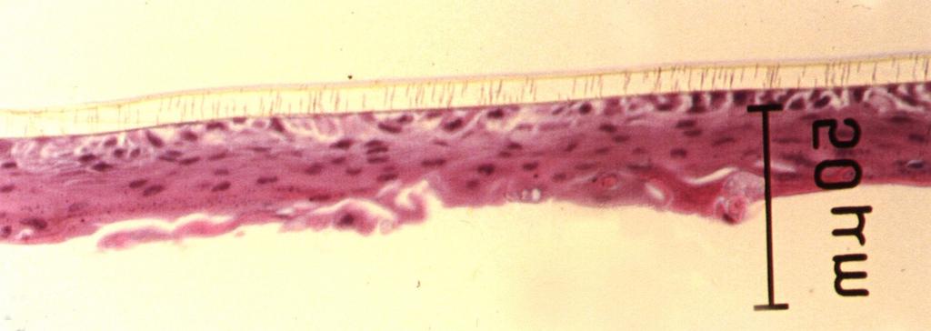 A In the airliquid interface culture, the HCE cells formed a keratinizing stratified squamous epithelium that resembled an in vivo cholesteatoma.