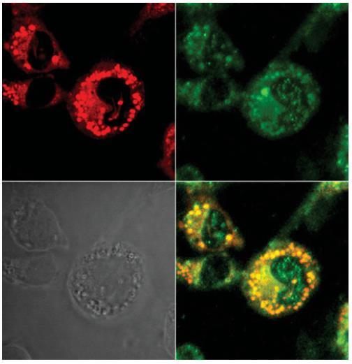Macrophage change to foam cell formation by CM remnant Lipid taken up from CMRs, regardless of their oxidative state, is not readily cleared from the cells by efflux (cholesterol) or metabolism (TAG)