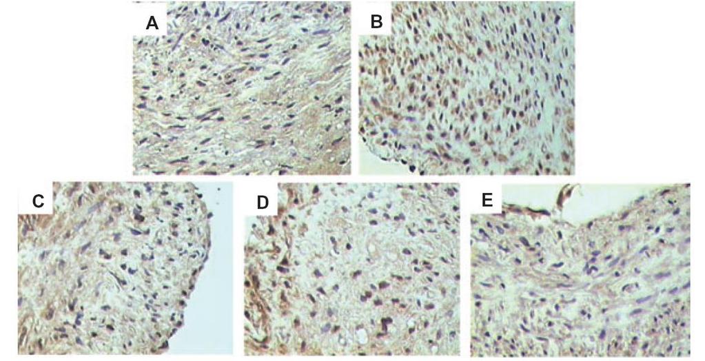 Ezetimibe/statin reduced migration of macrophage Immunolocalization of monocyte chemoattractant