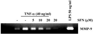 Journal of Life Science 2010, Vol. 20. No. 2 277 (A) (A) (B) (B) (C) (C) Fig. 1. Effect of sulforaphane on MMP-9 activity. (A) Raw 264.