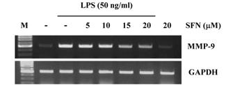 Conditional media were collected and LPS-induced MMP-9 activity was analyzed using gelatin zymography.