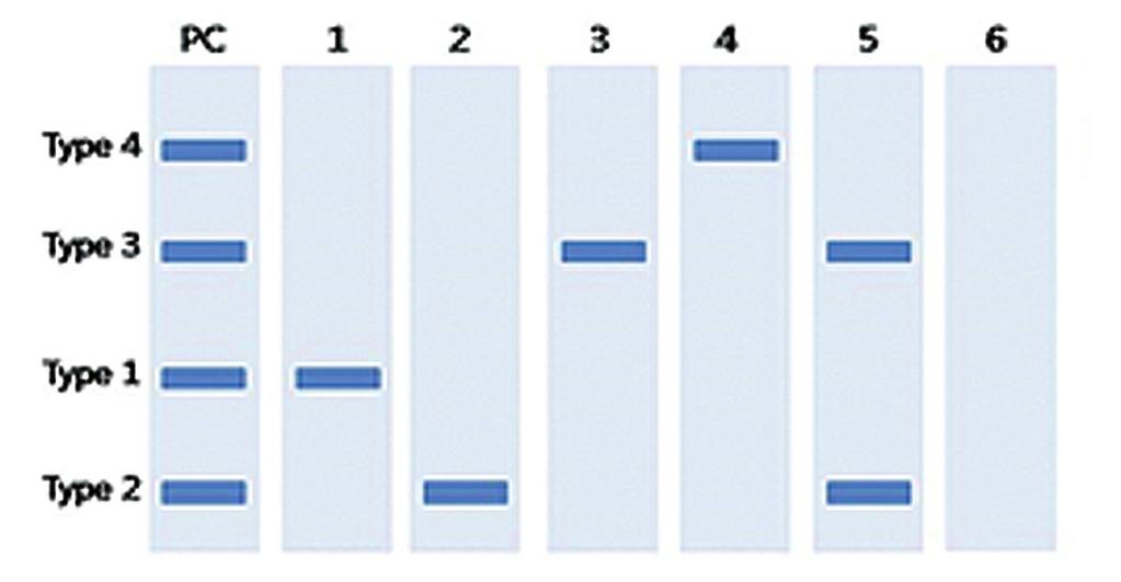 LabGun rt CT/NG Results PCR Kit (LabGun TM )