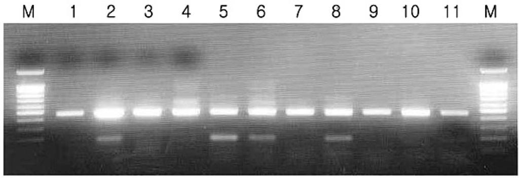 laidlawii를 제외한 모든 mycoplasma를 검출할 수 있었으며, 증폭산물의 크기는 균종에 따라 M. orale는 423 bp, M. hyopneumoniae는 681 bp, M. hyorhinis는 448 bp, 양성대조군은 810 bp 산물이 관찰되었다. 또한, 제조사의 사용설명서에 언급되 지 않은 균주에 대한 검출능을 조사한바 M.