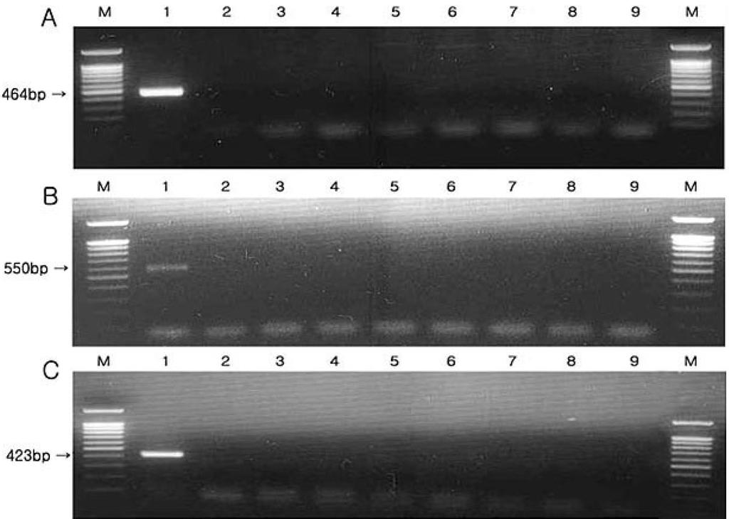 272 Woo-Jin Jeon et al. Kor. J. Microbiol Specificity of PCR using universal primers (A), R company's kit (B), and T company's kit (C). Lane M, 100 bp DNA ladder; lane 1, M.