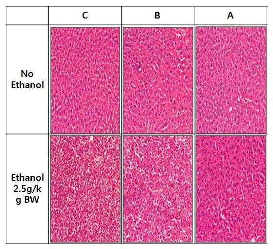 그림 17. Effect of a drink preparation containing herbal extracts on the ethanol-induced histological changes of the liver in mice.