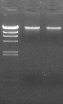 Experimental Example different sources of DNA extraction result of whole blood Purpose : Evaluated using TaKaRa