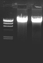 Material : Na 2 EDTA blood anticoagulant different sources Electrophoresis results : M 1 M 2 M 3 M 4 Source Material