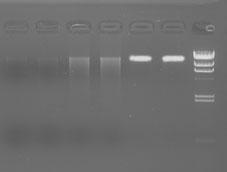 extraction results M :  extraction results Conclusion : TaKaRa MiniBEST Blood Genomic DNA Extraction Kit minimum blood extraction 1ul starting genomic DNA, DNA fragments were detected by