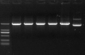 Recovery(%) The DNA recovery of agarose gel prepared by different electrophoresis buffers [Purpose] To compare the DNA recovery of agarose gel prepared by different electrophoresis