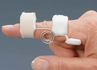 Three-point finger-based dynamic joint -aligned coil-spring PIP corrective Common Name: Capener splint 목적 :