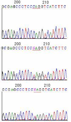 대한내분비학회지 : 제 21 권제 3 호 2006 C Fig. 5. Direct sequence analysis of exon 1 of the VHL gene. Germline mutation at exon1 codon 217, C T (Q73X).. Wild type (patient's son).. Index patient. C. Her daughter.