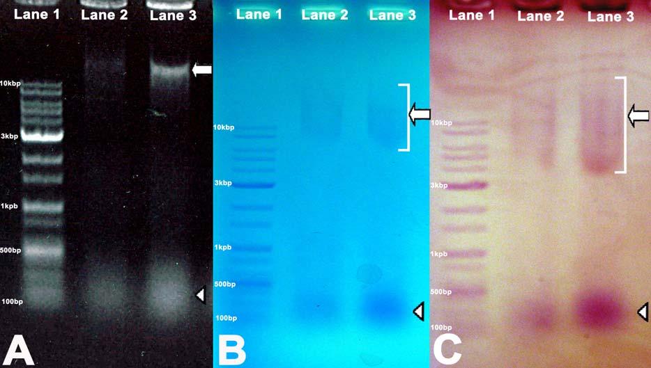 현장과학교육 1(2) 그림 5. 브로컬리 DNA 전기영동사진. (A-C) 첫번째줄 (Lane 1) 은 DNA 크기를측정하기위한표준크기마커 (size marker) 이며, 2번줄 (Lane 2) 에는 DNA 5mg을, 3번줄 (Lane 3) 에는 10mg을넣은것이다. (A) EtBr 염색을통한 DNA의확인.