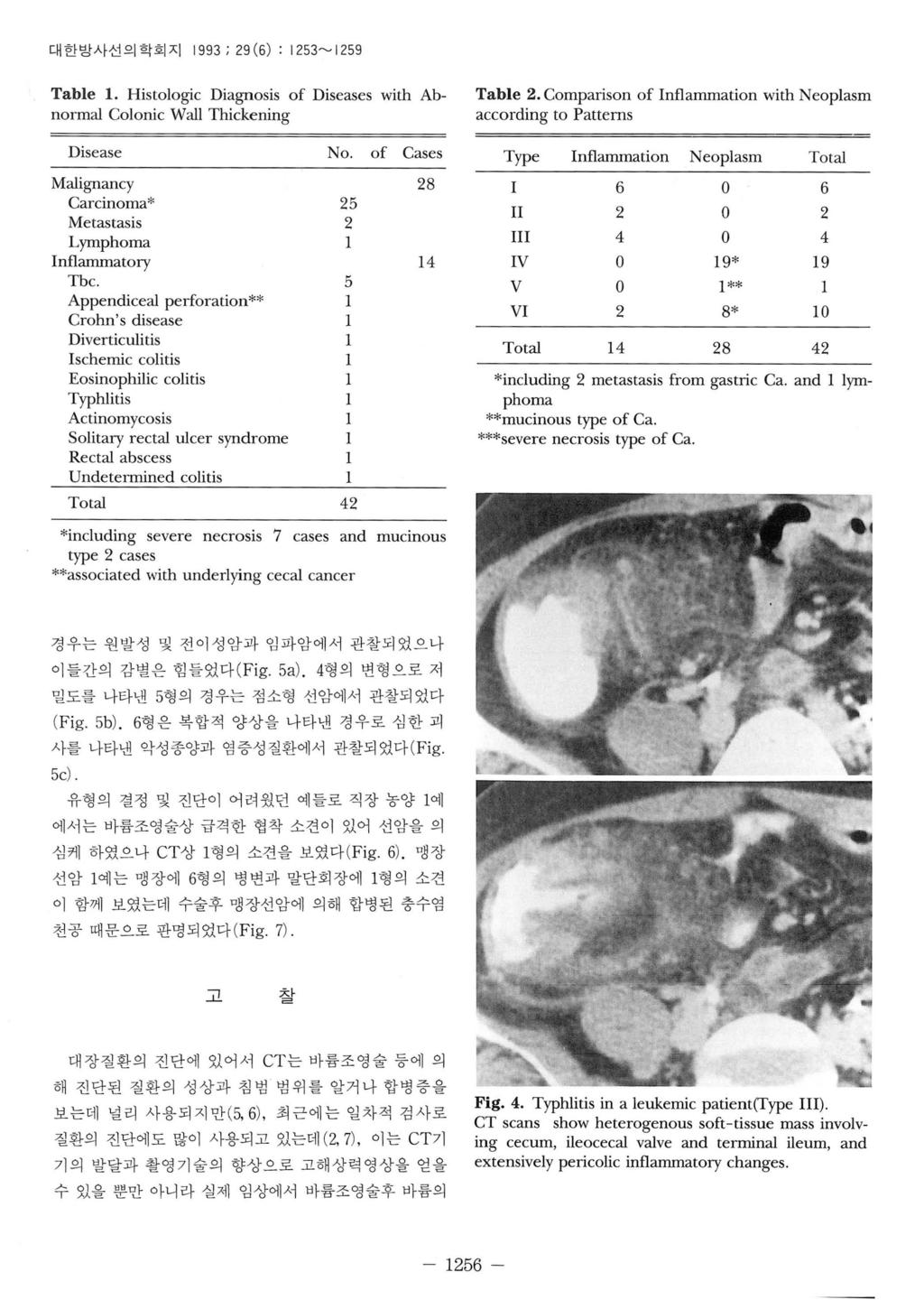대한방사선의학회지 1993 ; 29 (6) : 1 253~ 1259 Tble 1. Histologic Dignosis of Diseses with Abnorml Colonic Wll Thickening Tble 2.
