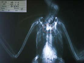 18. 괭이갈매기 -2 도요목갈매기과 18. Black-tailed Gull -2 Larus crassirostris 사건 : 2008년 11월 14일낙동강하구에서발견된사체를부산야생동물치료센터여광영수의사가 X-ray를촬영한결과식도에서낚싯바늘을확인하였다.