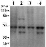 Fig. 7. Kinase assay of cell-free extracts. Kinase assay of endogenous proteins was conducted using cell-free extracts from 1-day and 5-day old culture of both Ep155/2 and UEP1.