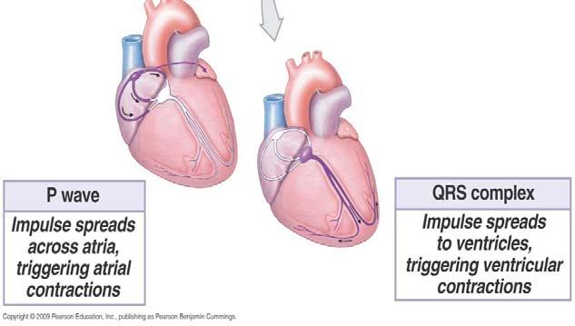 심전도 (Electrocardiogram, ECG) 심장의전기적활동을기록하는진단적도구 P 파 : 심방탈분극, 심방수축