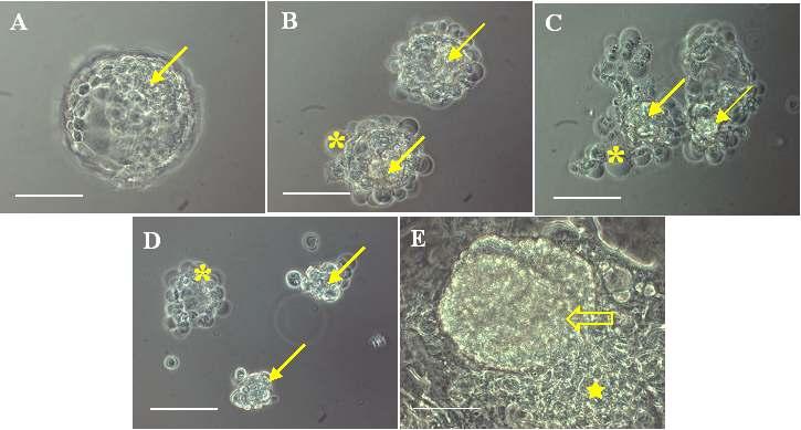 2. 인간배아줄기세포주의확립 가장널리이용되는 antibody( 항체 ) 와 complement( 보체 ) 를이용한 immunosurgery 방법 ( 그림 1) 으로