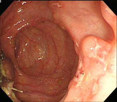 2016 gastroenterology