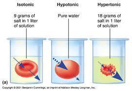 탈수 (Dehydration) 세포외액의소실로부터발생탈수지속 저혈량성쇼크 (hypovolemic shock) 사망 탈수의종류 1) 저장성 : Na+ 130mmEq 이하,