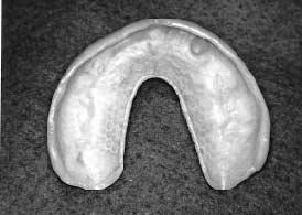 and index for inner surface of overdenture Fig.