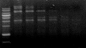 DNA preparation LacZ M 1 2 3 4 5 6 7 8 9 10 11 2 조각 1 : vector 2-3 : 2 fragment 4-6 : 4 fragment 4, 6-11: 6 fragment 4 조각 Transformation :