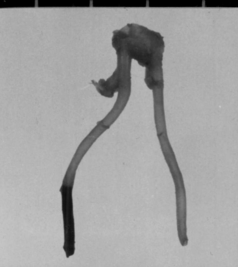 Fig. 5. Balloon-injured carotid artery luminal diameter comparing with the uninjured artery.