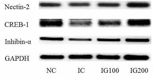 group. p<0.01 compared with IC group. p<0.05 compared with IC group. mrna CREB-1 Inhibin-α immobilization stress (p<0.05) GINST (p<0.01~0.05) Fig. 34.