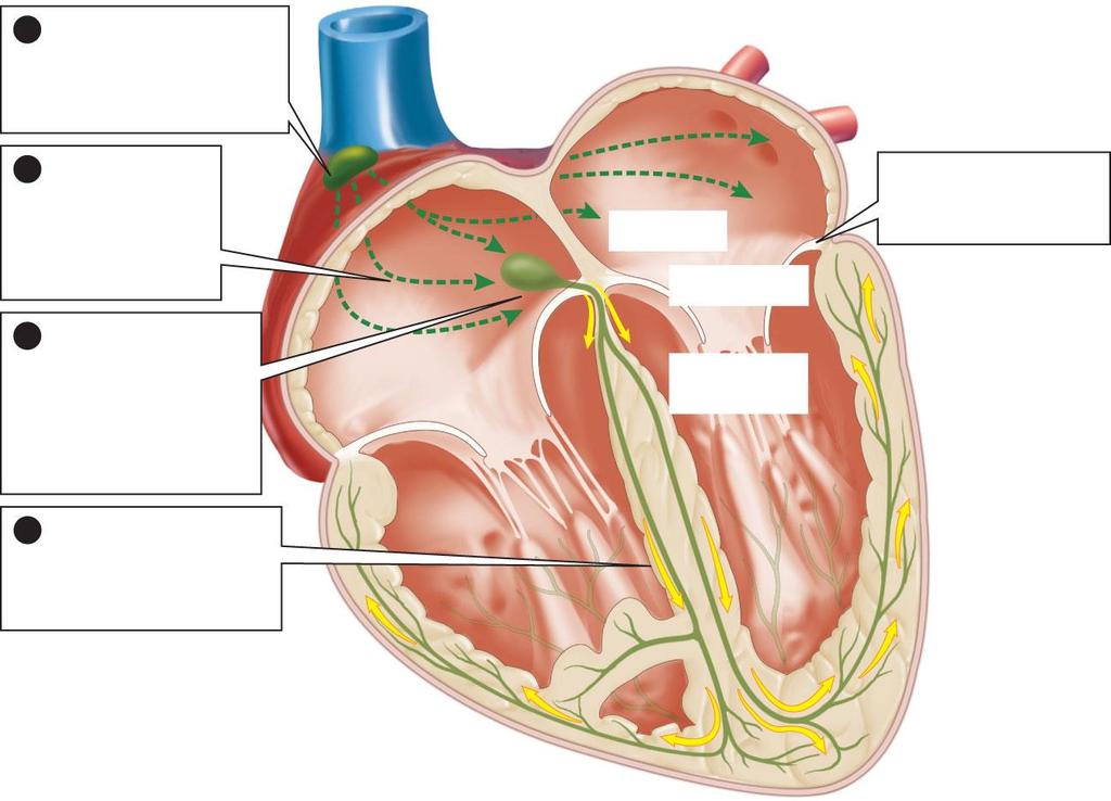 Step 5 1 An electrical signal from the sinoatrial (SA) node starts atrial contraction SA node 2 The electrical signal spreads through the atria, causing them to contract 3 The signal enters the