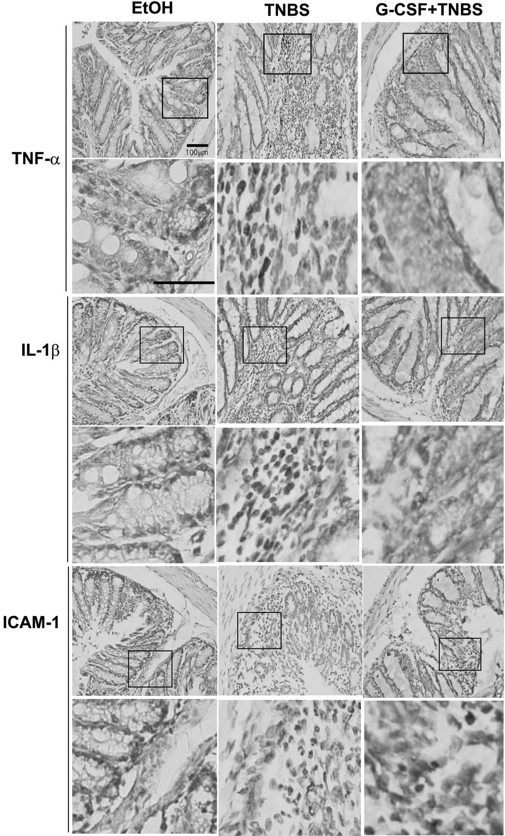 G-CSF Attenuates Inflammatory Bowel Diseases 17 Figure 4. G-CSF reduces the expression of TNF-α IL-1β, and ICAM1 in colonic mucosa of TNBS colitis.
