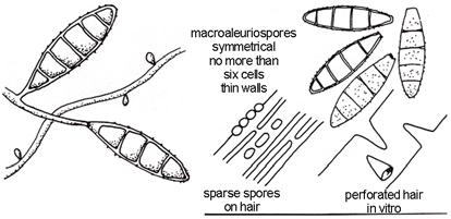특징적 Long, spindle shaped, rough, thick walled 손잡이 (knob) 같은끝, 6개이상의세포 Microconidia: a few M.