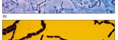Neisseria - 연쇄상구균 : 사슬모양