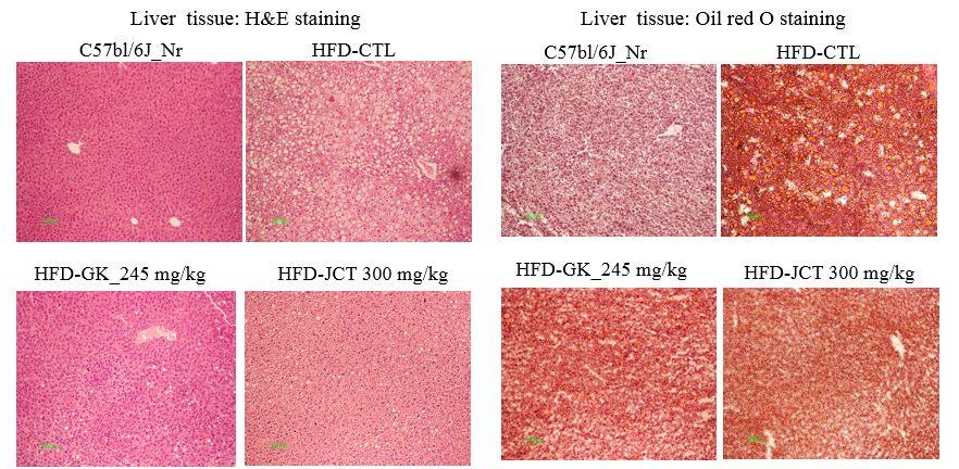 18 Anti-obesity Effect of Jeoreongchajeonja-tang in a High-fat Diet-induced Obesity Mouse model 상에 큰 지방구들이 보이며, 또한 H&E 염색과 Oil Red 2) 부고환 지방 세포의 병리조직학적 분석 O 염색시 회색 지방축적세포들이 넓게 분포하는 지방 고지방 식이로 유도된 흰 쥐
