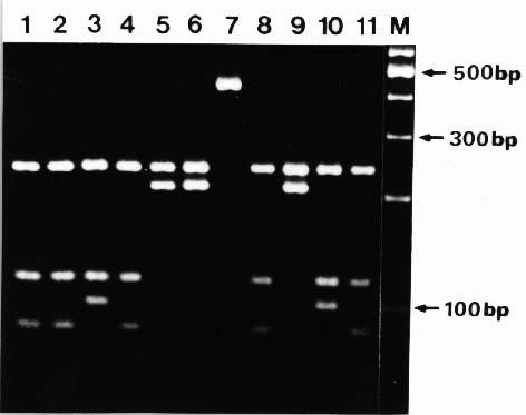 intracellulare(atcc 13950);11, M. fortuitum(atcc 6841). Fig. 2. HaeIII REA patterns of the 441bp amplification products from 11 reference strains. Lanes:M, 100bp DNA ladder; 1, M.