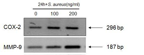 Fig. 5. mrna Expression of COX-2 and MMP-9 in HEKs Fig. 6. mrna Expression of IL-5 in HEKs 라. 아토피피부염세포모델에서염증표지자의변화실험 ( 단백발현실험 ) ; Western blot analysis HEKs에 S.