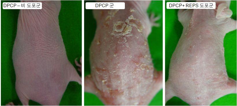 그림 1) Hairless 마우스에 1% DPCP 를도포하여아토피피부염을유도한후 REPE 연고에 대한항염증효능평가 ; Control -vehicle ointment 를처리한그룹, 1% DPCP -1% DPCP 연고를도포한그룹, 1% DPCP+REPS- 1% DPCP 와 5 % REPE 연고를함께도포한그룹 DPCP 도포로유도된피부염증에는홍반,