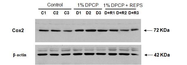 라. 아토피피부염이유도된마우스피부조직에서 COX-2 발현에대한 resveratrol의영향 3가지마우스그룹 (DPCP 도포군, 대조군그리고 DPCP와 REPS 연고를함께도포한군 ) 에대해염증표지자인 COX-2에대한발현을 Western blot 분석으로확인하였다. 그결과 COX-2의발현이대조군에비해 DPCP를도포한그룹에서발현이현저히증가되었다.
