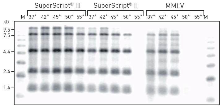 Reverse transcriptase 문헌에서매우많이인용되고참조된 SuperScript 역전사 효소 (reverse transcriptase, RT) 제품군은 cdna 합성에최 상의선택인역전사효소입니다. SuperScript RT 는전체길 이 cdna 의수율을높이기위해신뢰성과효율성을갖도 록설계되었습니다.