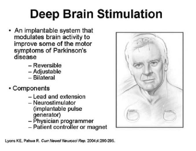 배영란 : Parkinson s Disease 의약물요법 Fig. 7 Deep brain stimulation 리하면서수술부위를조절할수있으며전극을제거해버릴수있어뇌손상이적은장점이있다. 그러나일정시간이지나면전지를교환하기위해수술을받아야되는불편함과고비용의단점이있다. Yeungnam University. J. of Med. 2007; 24:Suppl. p.