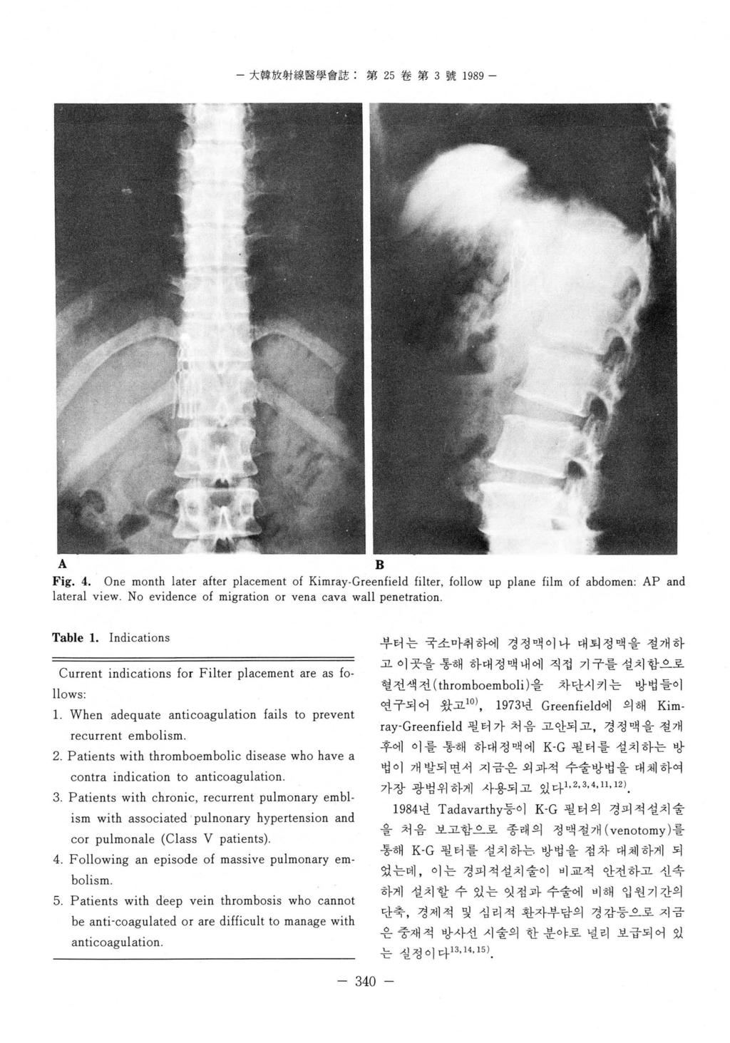 - 大韓放射線醫쩔會誌 : 第 25 卷第 3 號 1989 - B Fig. 4. One month later after placement of Kimray.Greenfield filter, follow up plane film of abdomen: AP and lateral view.