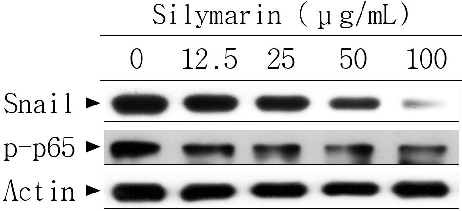 Korean J Clin Lab Sci. Vol. 50, No. 3, September 2018 341 두전사인자의활성은 silymarin에의해유의적으로억제되었다 (Figure 4).