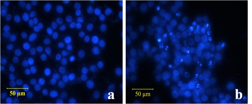 A number of shrinking nuclei are observed in the experimental group(b) compared with control(a). Fig. 6. Detection of apoptosis by DAPI-staining in the KB cell lines.