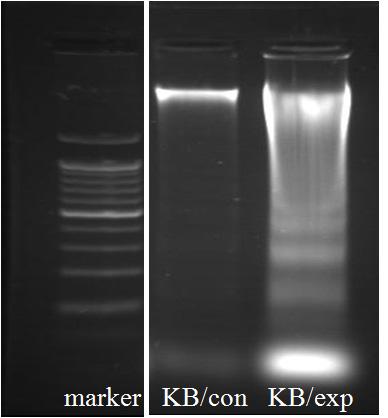KB-cell line were treated with Salviae (1.5 / ) for 72hr. DNA laddering 1.5% agarose gel electrophoresis in SYBR.