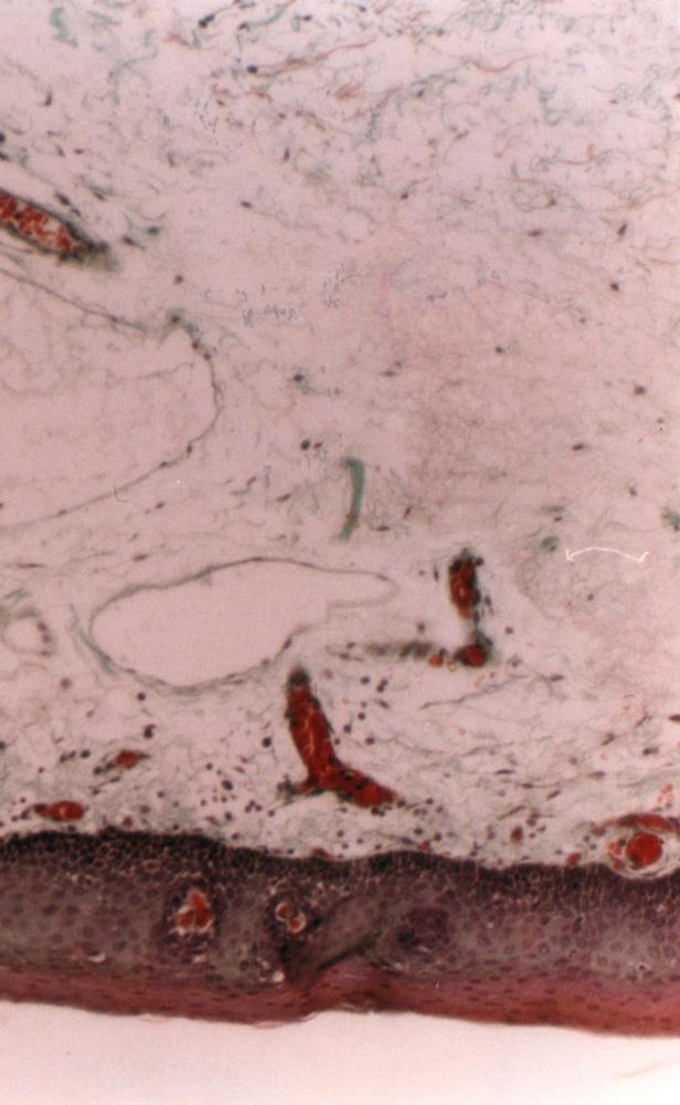area was shown in this photomicrograph